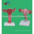 the uterus enlarge Model,uterus model